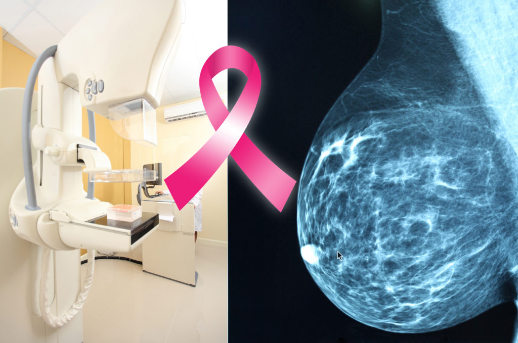 Pink Ribbon For Breast Cancer Awareness On Mammogram Image