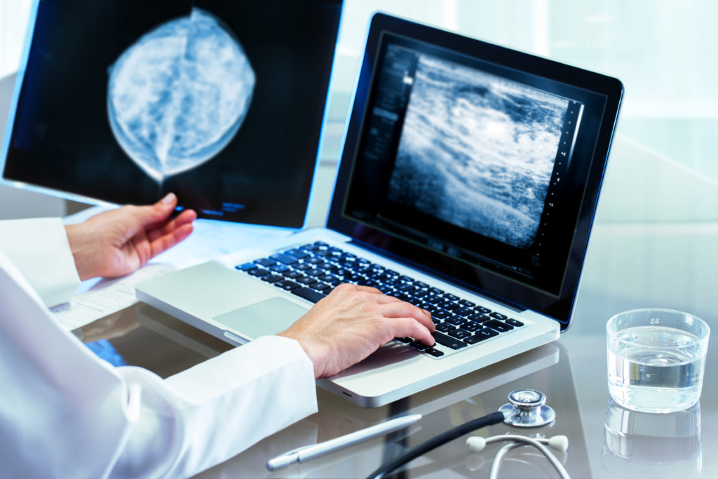 Doctor Reviewing Mammography Results On Pc.