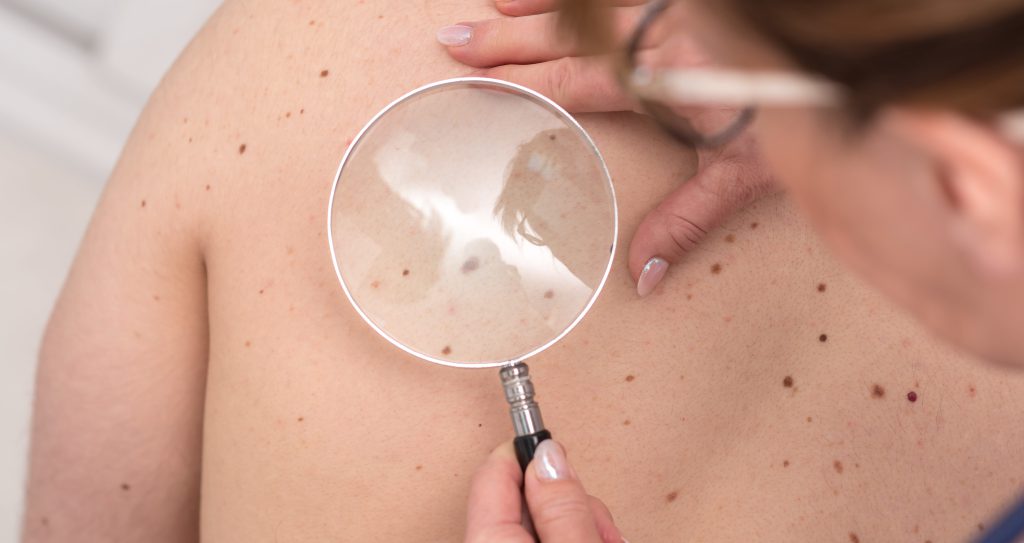 Dermatologist Examining The Skin Of A Patient