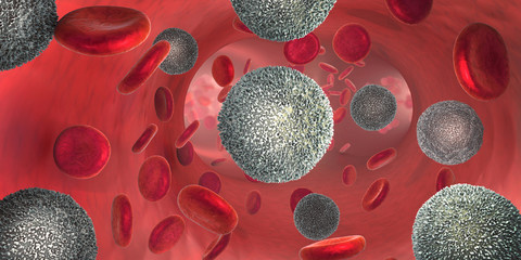 240 F 238268271 Rujtpgf41Nqc1Zcqlfh1Thm9Pkraxsqp Leukemia