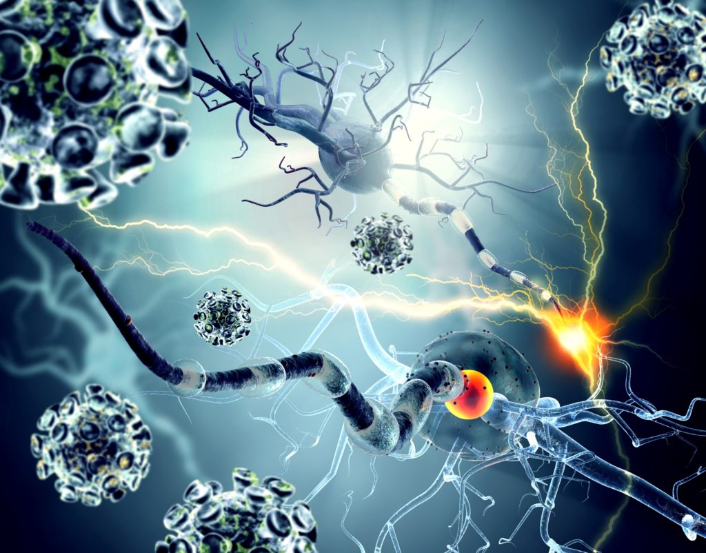 Image For Fighting Brain Cancer At Virginia Cancer Specialists VCS:  Better Options, Better Outcomes -  Timothy A. Mccarthy, MD