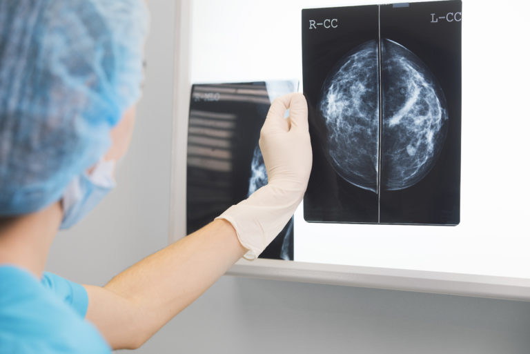 Woman Doctor Or Nurse In Surgery Outfit Is Holding A Mammogram In Front Of X Ray Illuminator