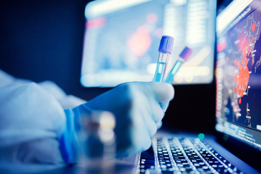 Analysis number of infected people in China and world from virus, doctor in protective chemical suit with respirator computer in laboratory.