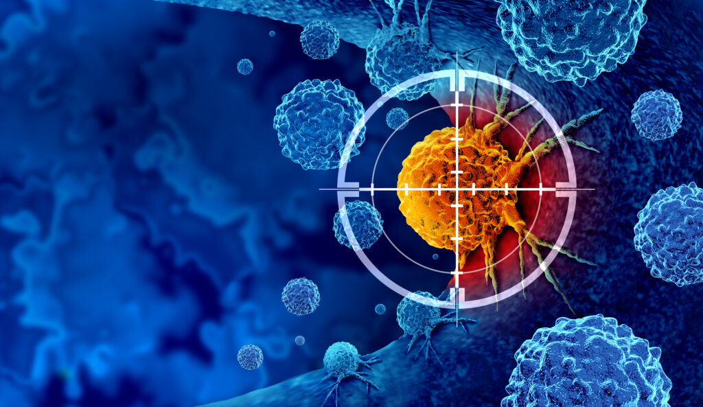 Cancer detection and screening as a treatment for malignant cells with a biopsy or testing caused by carcinogens and genetics with a cancerous cell...