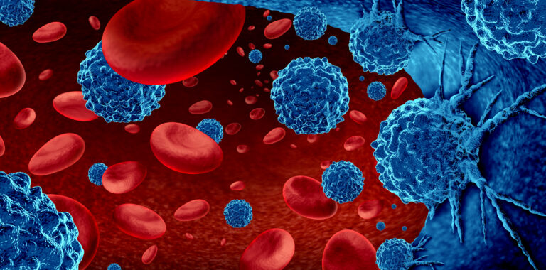 Cancer in the blood outbreak and treatment for malignant cells in a human body caused by carcinogens and genetics with a cancerous cell as an immun...