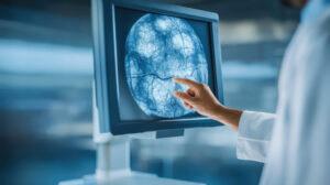 Diagnostic imaging scan of breast tissue monitor showing dense veinlike structures examined by