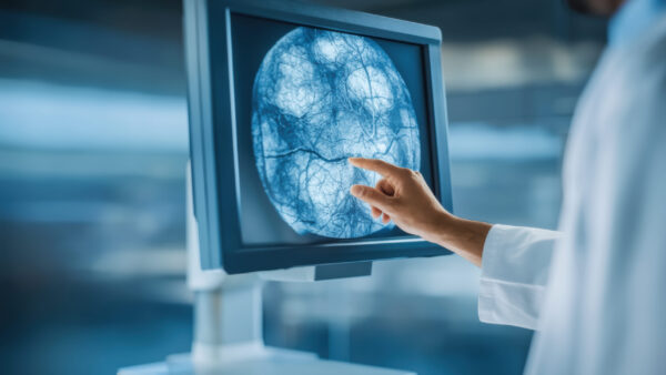 Diagnostic imaging scan of breast tissue monitor showing dense veinlike structures examined by